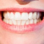 Aktualna technologia używana w salonach stomatologii estetycznej być może sprawić, że odzyskamy piękny uśmiech.