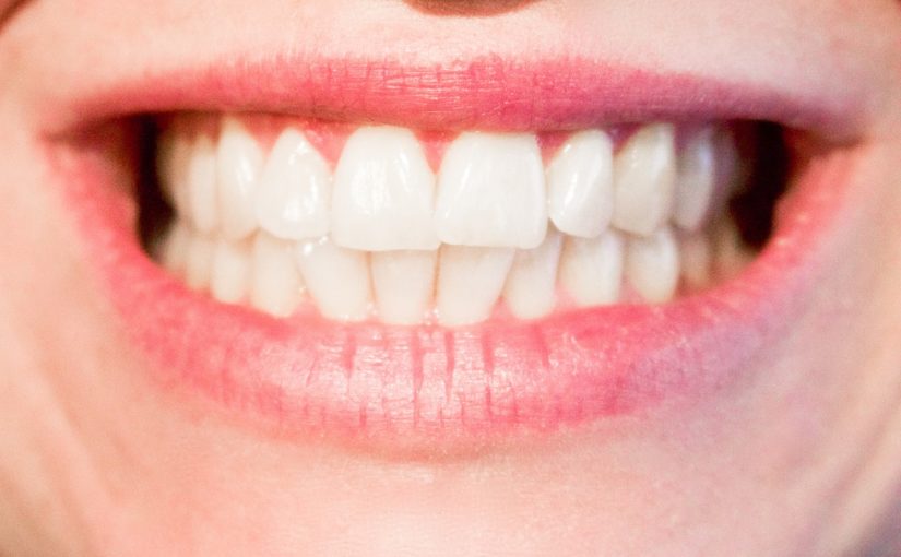 Aktualna technologia używana w salonach stomatologii estetycznej być może sprawić, że odzyskamy piękny uśmiech.